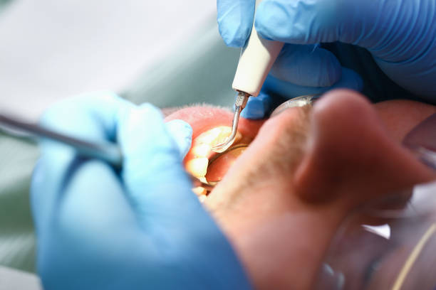 Best Emergency Dental Care for Sports Injuries in New Ulm, MN