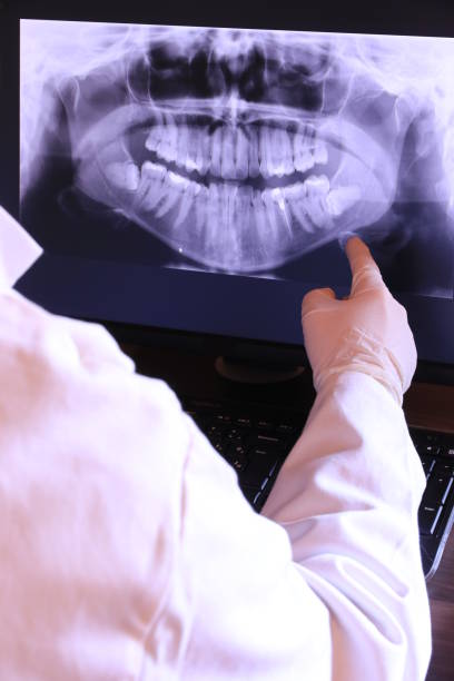 Best Knocked-Out Tooth (Avulsed Tooth) Treatment in New Ulm, MN
